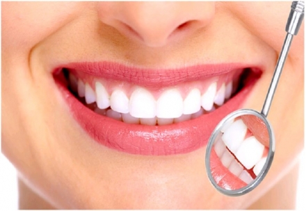 So sánh ưu điểm và nhược điểm các loại răng sứ
